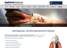 implantat-berater.de